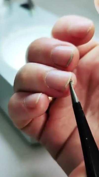 Bacteria in your Nails