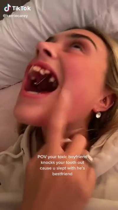 So-called &quot;toxic&quot; boyfriend breaks cheating girlfriend's tooth.