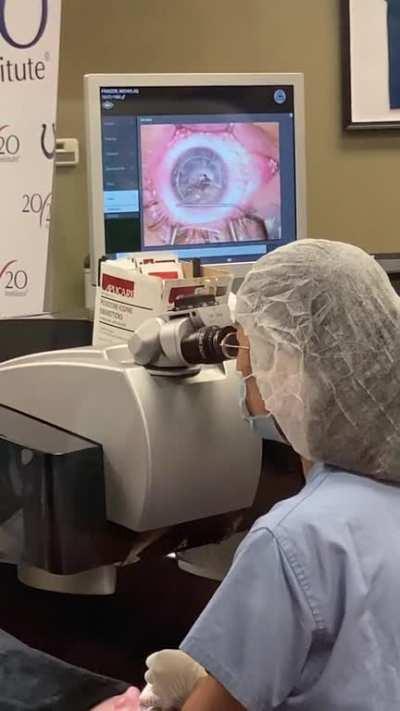 LASIK procedure. Going from 20/2300 to 20/20 in 10 minutes.