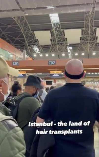 Istanbul Airport dubbed “hairport” after dozens fly after receiving hair transplants