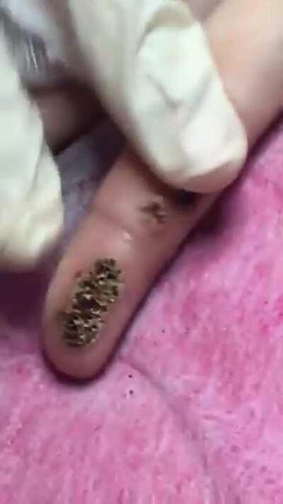 Fuck this shit hits my trypophobia and makes my skin crawl