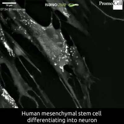 Human stem cell differentiating into a neuron