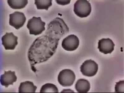 White blood cell chases Bacteria ( Come here you little piece of shit )