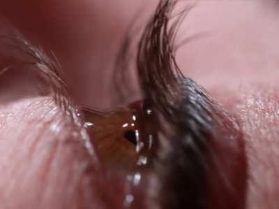 Close-up of eye drops in slow motion