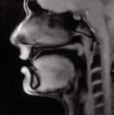 This is a mri of someone talking