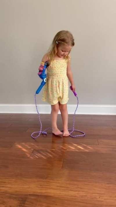 Jump rope prosthetic in action