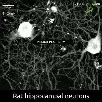 Some live neurons FYI - will place link sharing the details in the comments