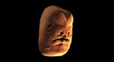 How the human face develops in womb