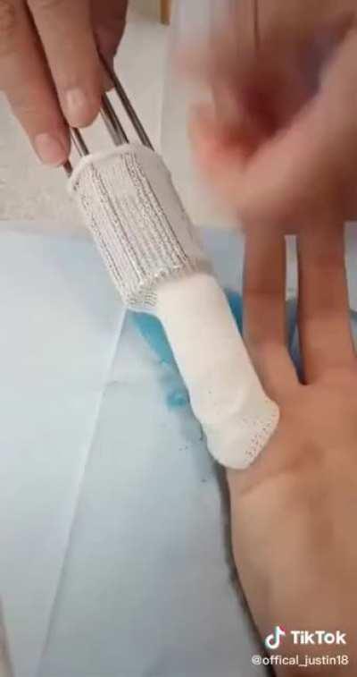 The use of the finger wrapper