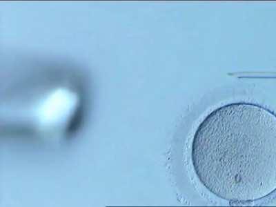 Creating a human: injecting single sperm directly into a woman’s egg in-order to create a fertilized embryo. This is an advanced reproductive procedure, called Intracytoplasmic Sperm Injection (ICSI), done in an embryology lab during an IVF treatment.