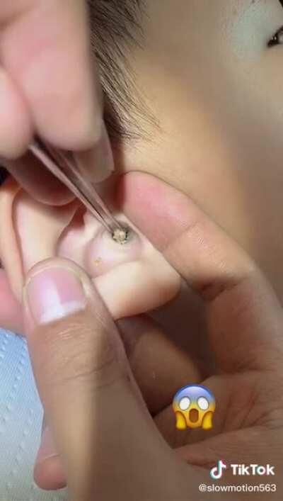 Earwax......