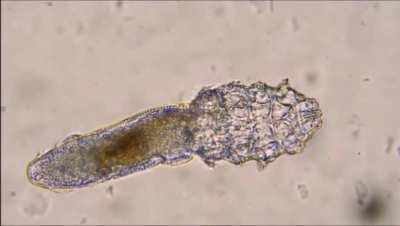 'Face Mites' they live in your pores, eat your grease and mate on your face while you sleep