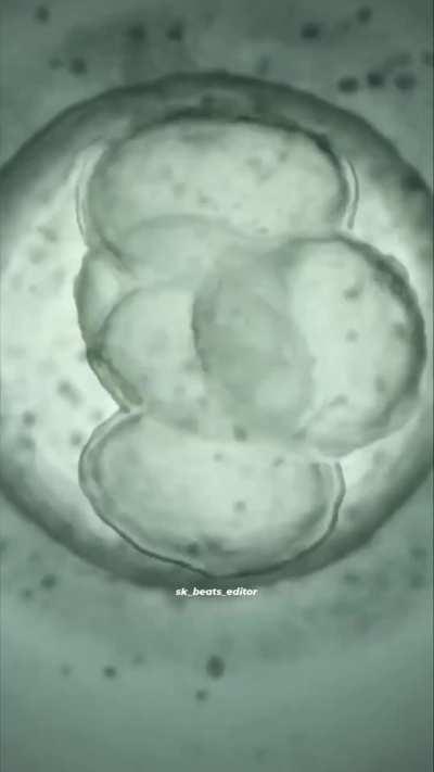 In vitro fertilization. During this procedure of fertilization, mature eggs are collected from ovaries and fertilized by sperm in a lab.