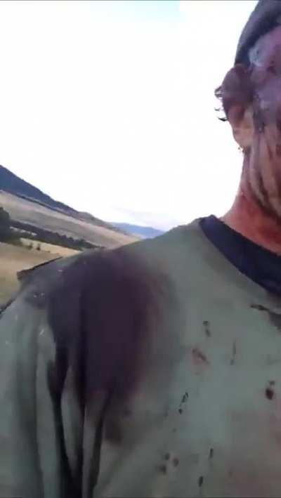 Hunter survives double grizzly bear attack