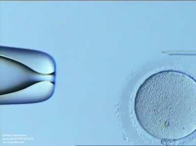 How a single sperm is selected and injected directly into the egg using a fine glass needle