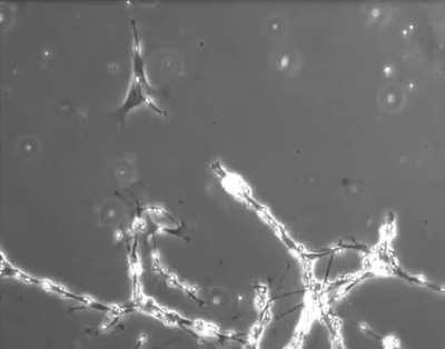 Single neuron tries to make a connection with the rest of the network