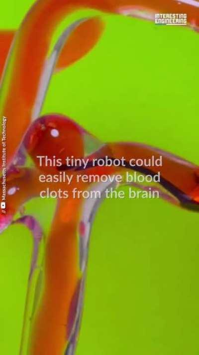 Could robots get inside our brain