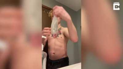 Guy born without collarbones can clap his shoulders