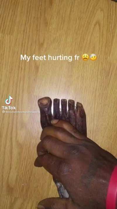 Cursed feet