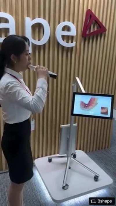 This tooth scanning technology