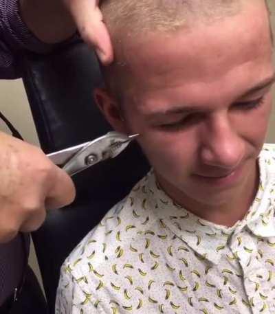 Guy gets rod removed from head