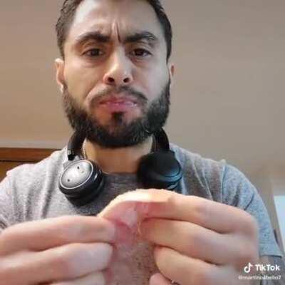 Dude eats raw salmon with live parasite to stimulate his immune system