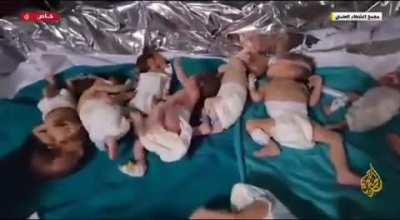 Unlike the 40 beheaded Israeli Children (which turned out to be fake), this is a video from Al Shifaa Hospital In Gaza. ممكن فيديوهات مترمجة زي هيك يخوان تنشروها عالانستا أو غيره أحسن من اشي مش مترجم