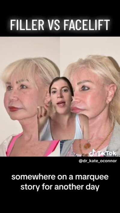 Young plastic surgeon thinks she nailed it, but the Before pic is better