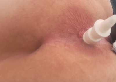 Closeup of my hungry ftm asshole pushing out a nose spray bottle