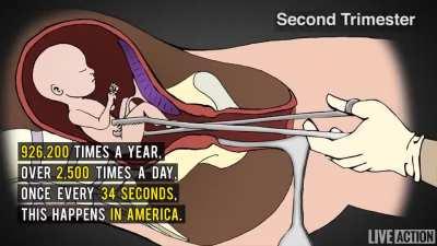 A powerful video on the reality of Abortion