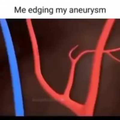 aneurysm rule