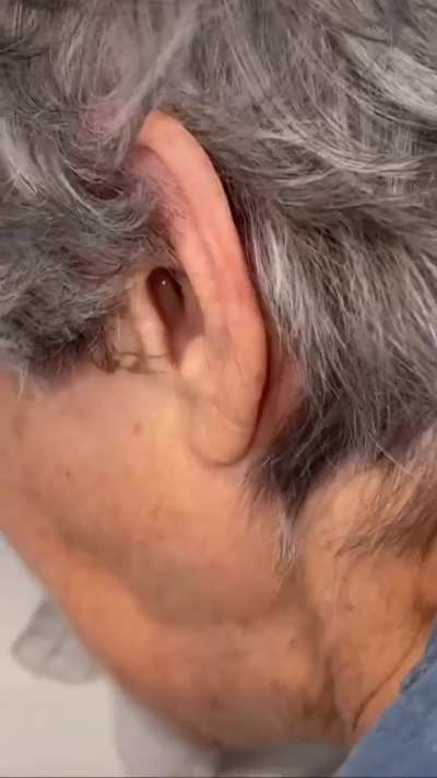 Hydrogen Peroxide is pretty good for softening ear wax