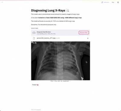 I wanted to try streamlit, so I trained a model to diagnose lung X-Rays (Pneumonia) and visualised it with streamlit [not hosted]