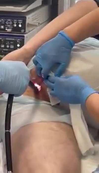 Doctor Pulling Out Cucumber From Man’s Butt