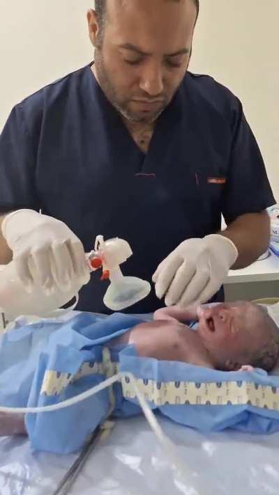 A doctor in Brazil CALMLY &quot;resurrecting&quot; a child that has just been born.