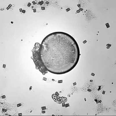 This microscopic water bear appears to be scratching its back, like big bears scratch on trees.