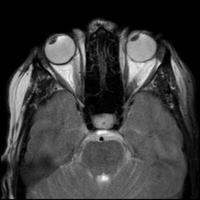 MRI scan of a person watching a ping pong match