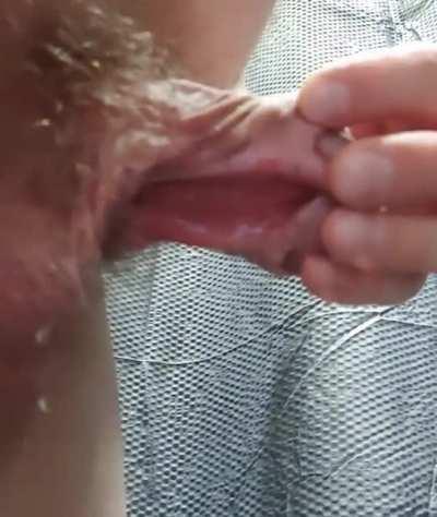 Pee with subincision penis is messy