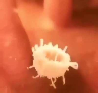 What a white blood cell looks like while attacking bacteria