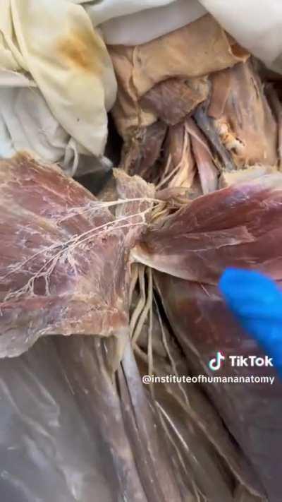 How our neck muscles (scalenes) envelop all the nerves going into our arms (brachial plexus)