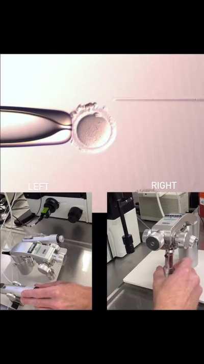 The procedure of injecting sperm into the egg.