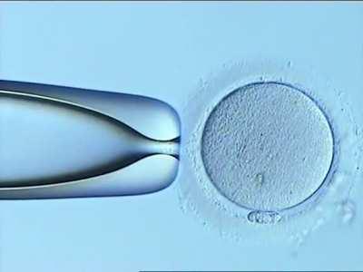 ICSI - injecting sperm in a mature egg