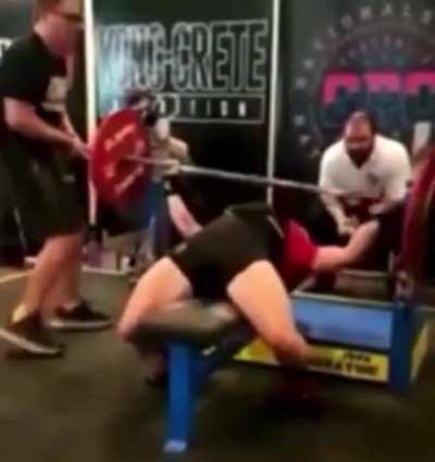 Woman’s arm fails on bench press