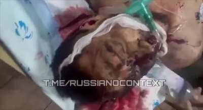 *graphic* a russian soldier lies very dead in a hospital with his brains blown out- bakhmut region