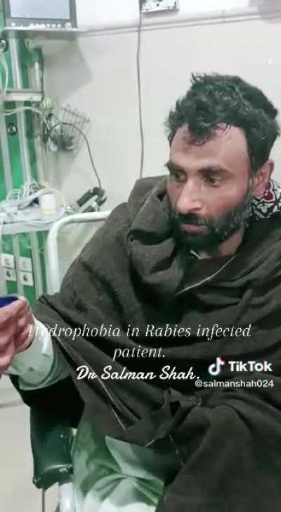 Hydrophobia in Rabies infected patient