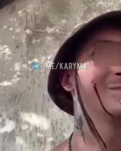 A Russian soldier filmed the moment a submunition of a cluster projectile hit his face