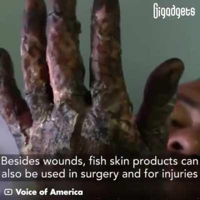 These special fish skin bandaids are being used to help treat skin burns