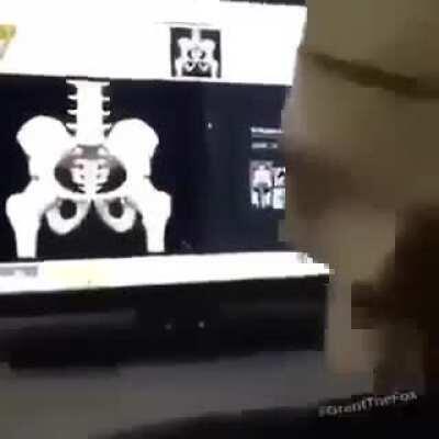 blursed_skeleton