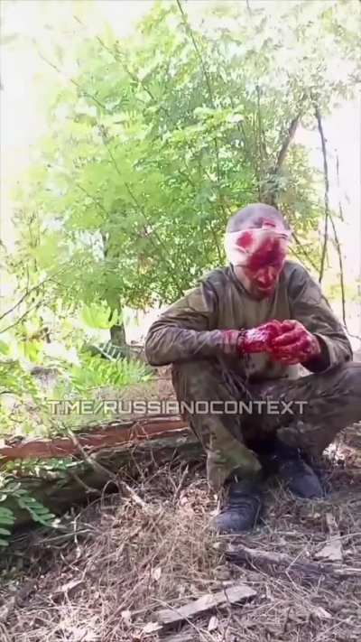 Russian survived his own suicide, failed headshot. 