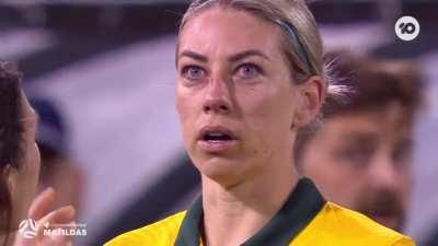 Soccer player sees her broken nose on the bigscreen